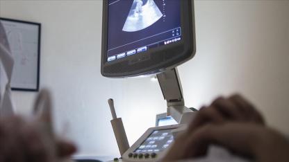 Her 10 kadından 1'inde endometriozis görülüyor