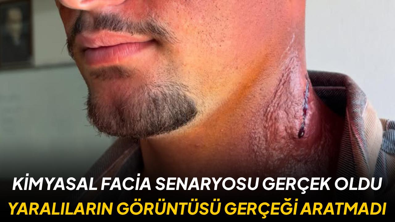 Gerçeği aratmayan tatbikat: Kimyasal yanıklar bile unutulmadı