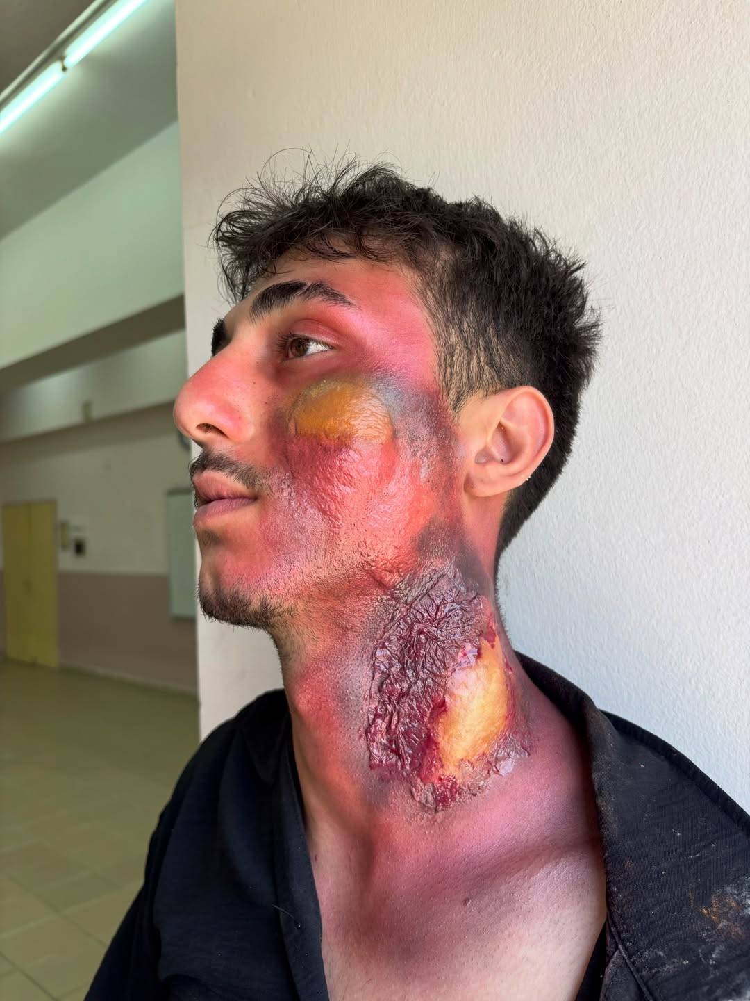 Gerçeği aratmayan tatbikat: Kimyasal yanıklar bile unutulmadı